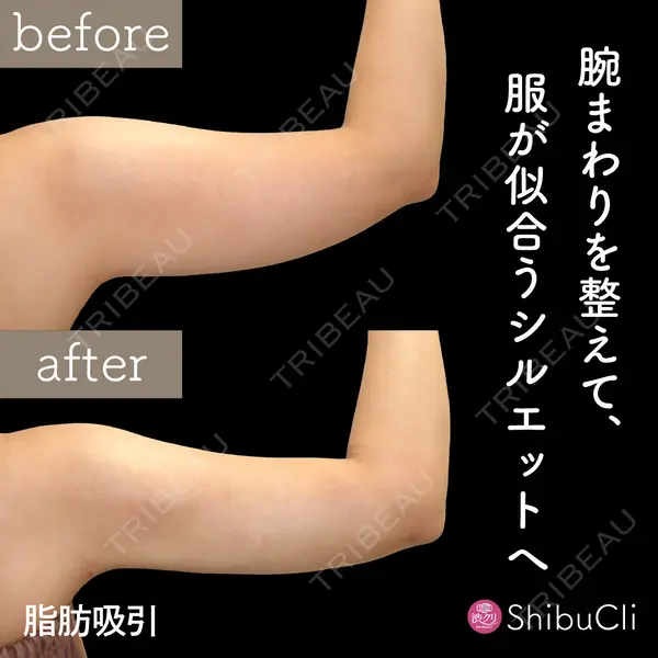 渋谷美容外科クリニック 新橋院の症例