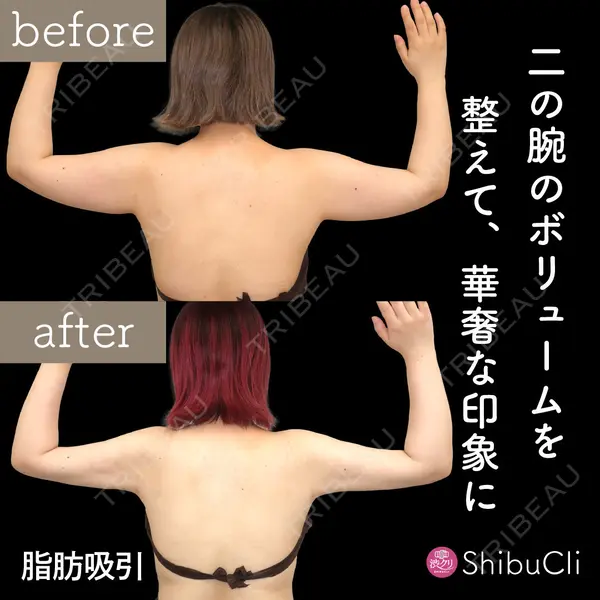 渋谷美容外科クリニック 新橋院の症例
