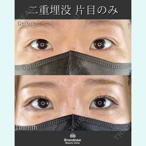 Brandnew Beauty Clinicの症例
