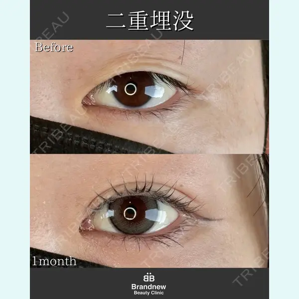 Brandnew Beauty Clinic 平山 容成医師の症例