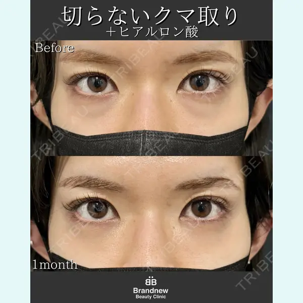 Brandnew Beauty Clinic 平山 容成医師の症例