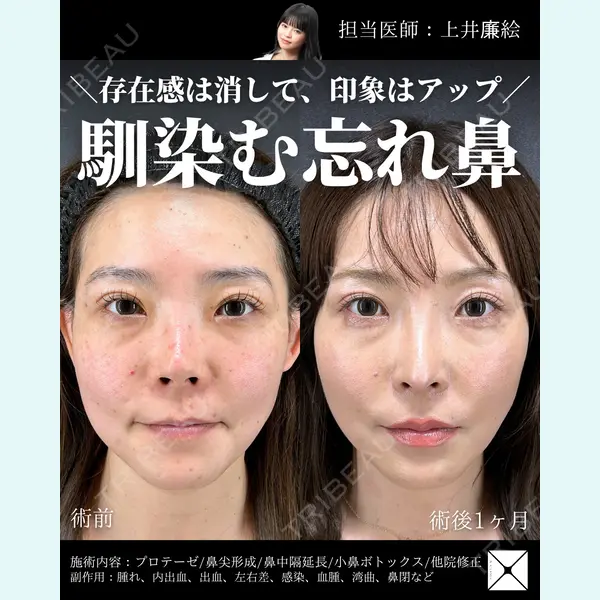 X CLINIC 恵比寿院の症例