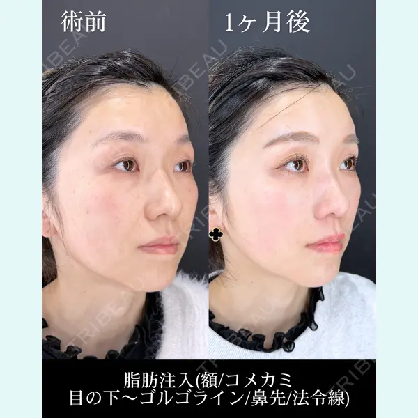 HAAB×DREAM BEAUTY CLINIC 大阪梅田院 鈴木 馨斗医師の症例