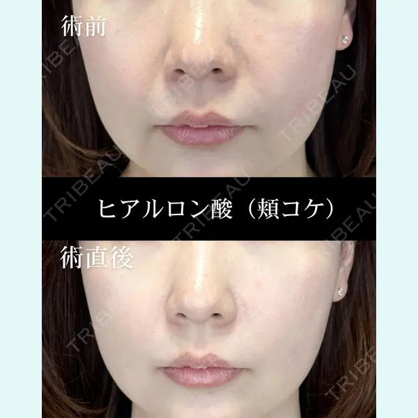 HAAB CLINIC 福岡院 北村 可恋医師の症例