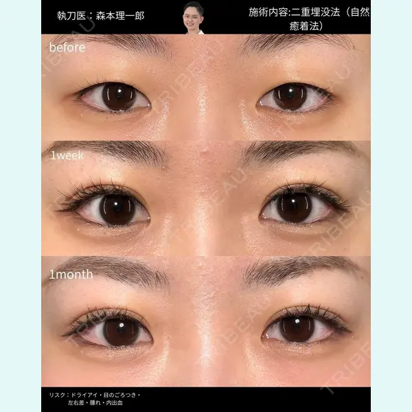 PRISM Beauty Clinic 町田院 森本 理一郎医師の症例