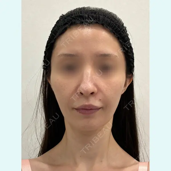 GRACY TOKYO CLINIC【グレイシートウキョウクリニック】 大西 真代医師の症例