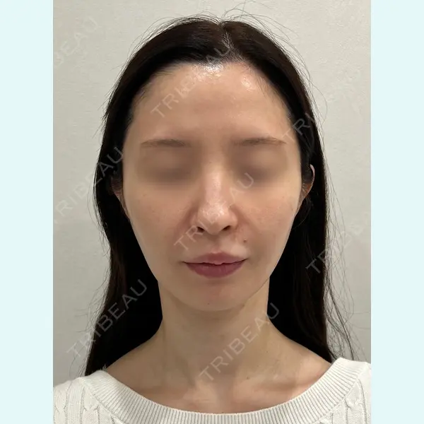 GRACY TOKYO CLINIC【グレイシートウキョウクリニック】 大西 真代医師の症例