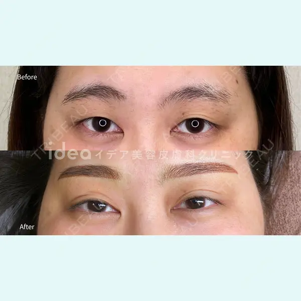 イデア美容皮膚科クリニック 柏院の症例