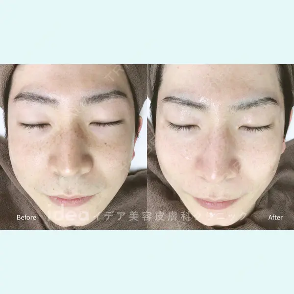 イデア美容皮膚科クリニック 柏院の症例