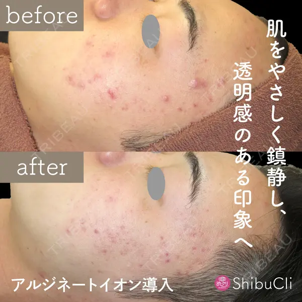 渋谷美容外科クリニック 池袋院の症例