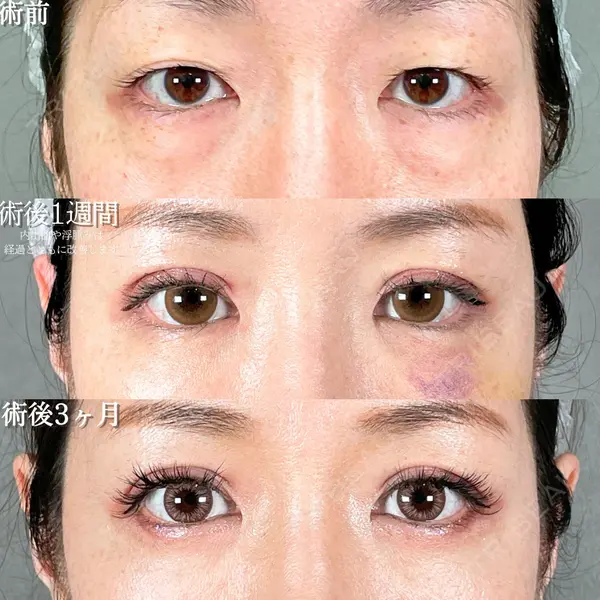 アリエル美容クリニック 大宮院 鈴木　桂介医師の症例