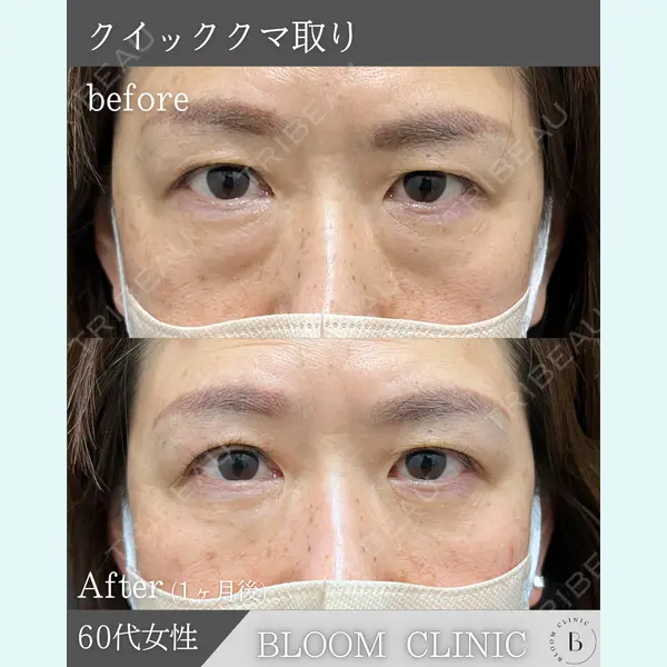 ブルームクリニック（BLOOM CLINIC） 大西 雅樹医師の症例