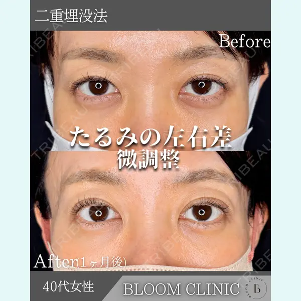 ブルームクリニック（BLOOM CLINIC） 大西 雅樹医師の症例