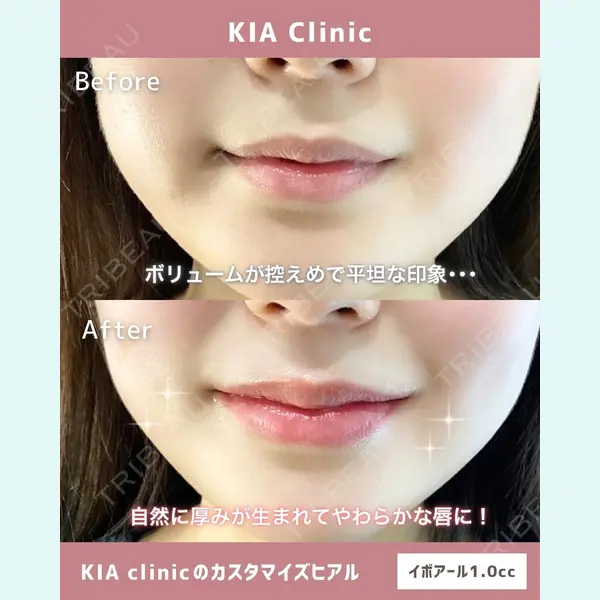 KIA CLINIC 心斎橋院 雲山　盛秀医師の症例