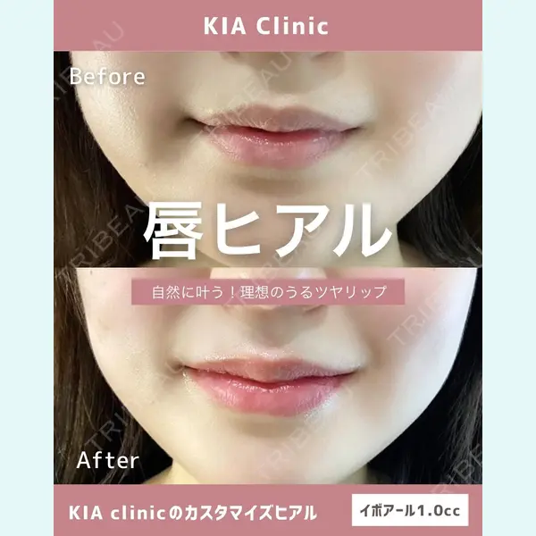 KIA CLINIC 心斎橋院 雲山　盛秀医師の症例