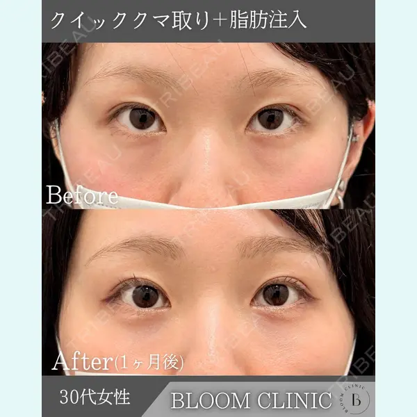 ブルームクリニック（BLOOM CLINIC）の症例