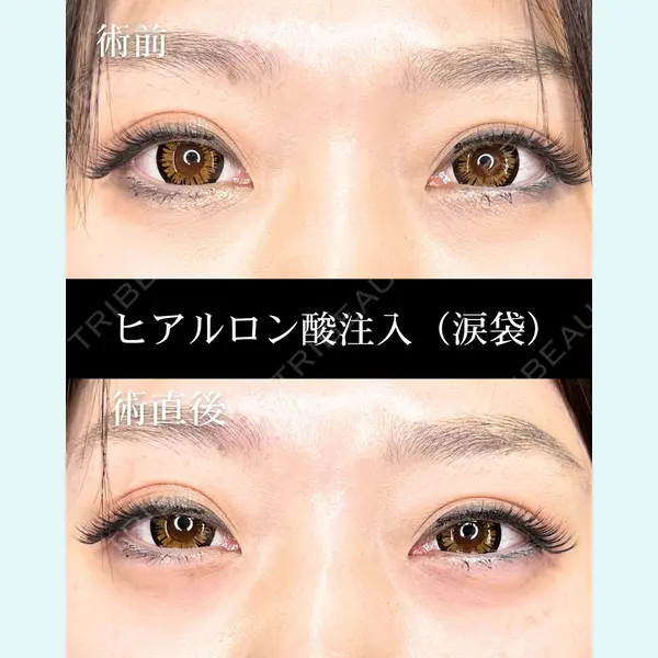 HAAB CLINIC 福岡院 米谷 拓朗医師の症例