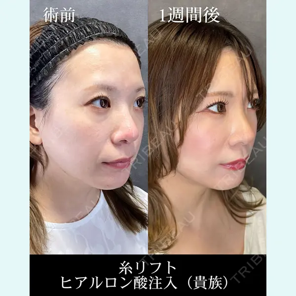HAAB CLINIC 福岡院 米谷 拓朗医師の症例