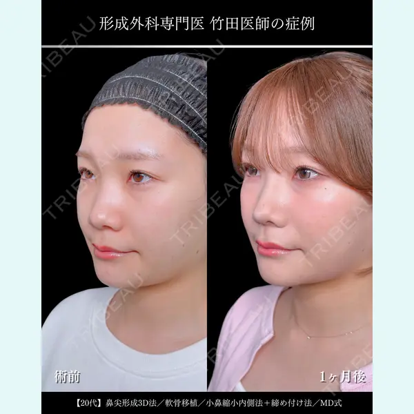 東京シンデレラ美容外科 大宮院 竹田 昌平医師の症例