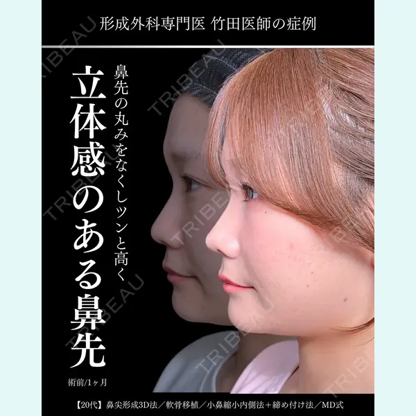 東京シンデレラ美容外科 大宮院 竹田 昌平医師の症例