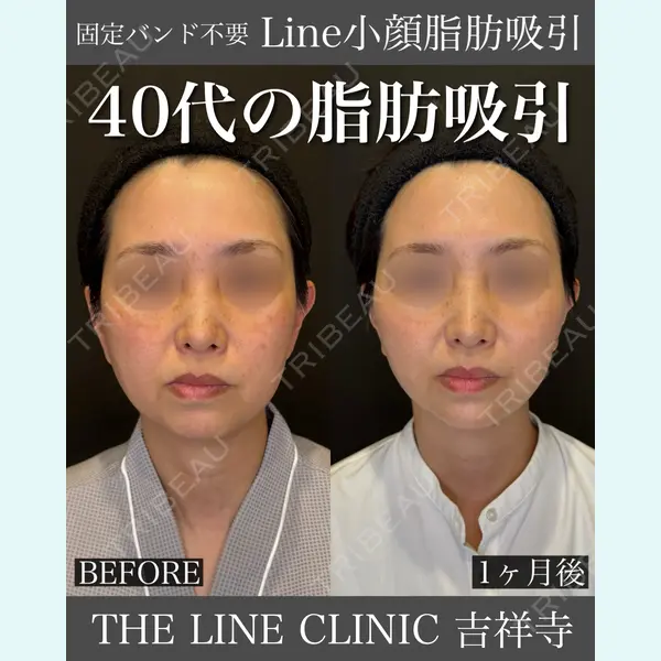 THE LINE CLINIC KICHIJOJI 三橋 克之医師の症例