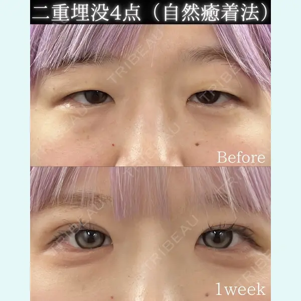 THE FIRST CLINIC 町田院 惟村 公郁医師の症例