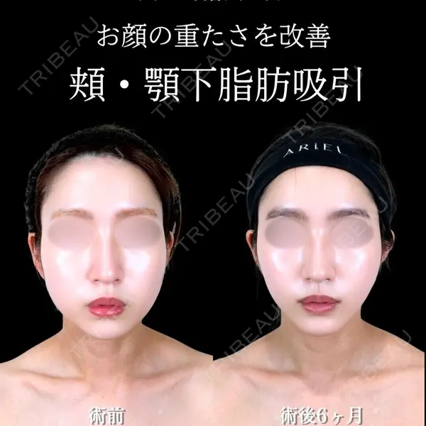 アリエル美容クリニック 横浜院 渡邉 光医師の症例
