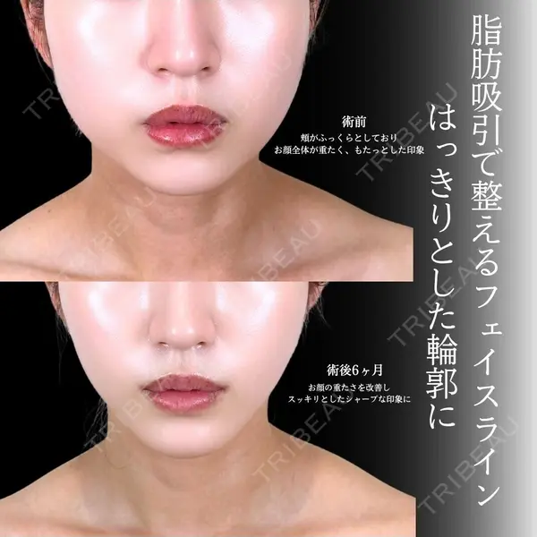 アリエル美容クリニック 横浜院 渡邉 光医師の症例
