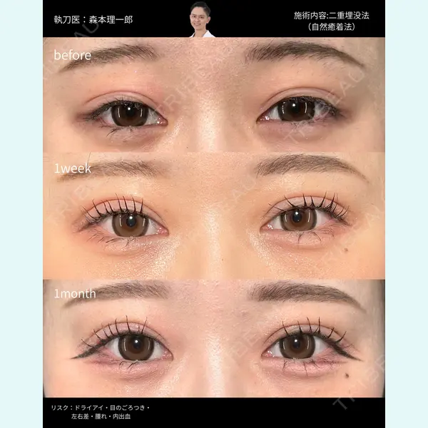 PRISM Beauty Clinic 町田院 森本 理一郎医師の症例