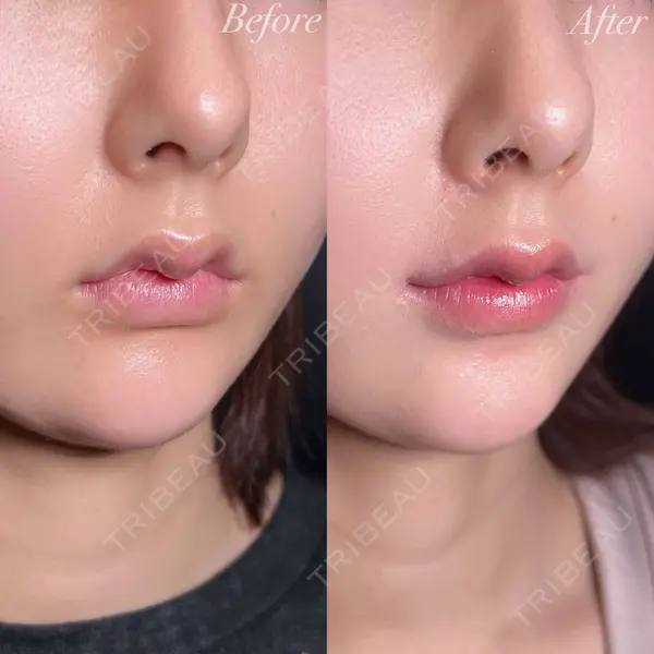 R Beauty CLINIC 大阪院 小池 泰弘医師の症例