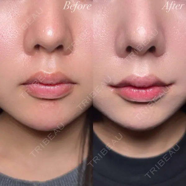R Beauty CLINIC 大阪院 小池 泰弘医師の症例