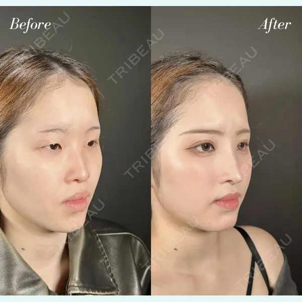 R Beauty CLINIC 名古屋院 木村 尚大医師の症例