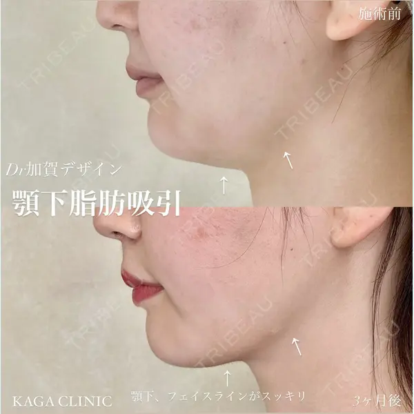 KAGA CLINIC 加賀 裕基医師の症例