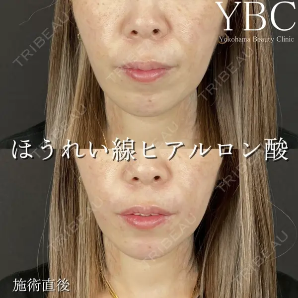 YBC横浜美容外科 立川院 大島 諒士医師の症例