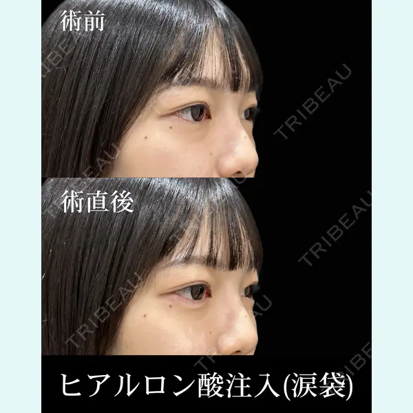 HAAB×DREAM BEAUTY CLINIC 東京本院 佐野 圭医師の症例