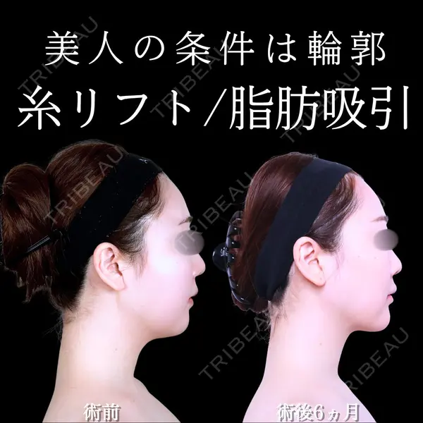アリエル美容クリニック 水戸院 天白 典秀医師の症例