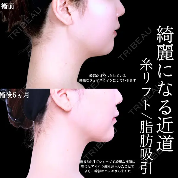 アリエル美容クリニック 水戸院 天白 典秀医師の症例