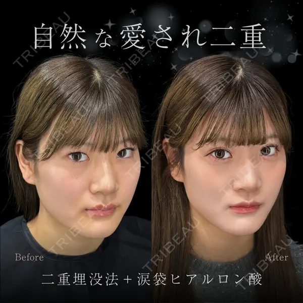 CROWN BEAUTY CLINIC 神山 豊医師の症例