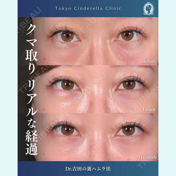 東京シンデレラ美容外科  横浜院 吉田 利之医師の症例