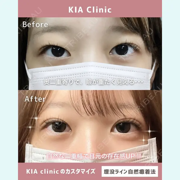 KIA CLINIC 心斎橋院 雲山　盛秀医師の症例