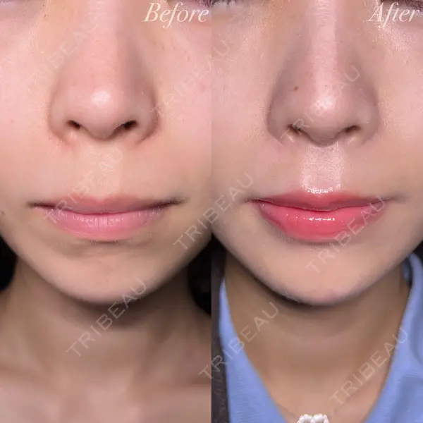 R Beauty CLINIC 大阪院 小池 泰弘医師の症例