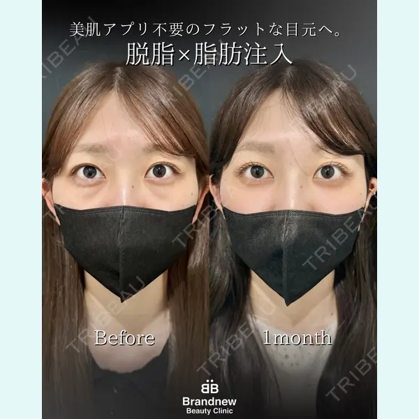 Brandnew Beauty Clinic 平山 容成医師の症例