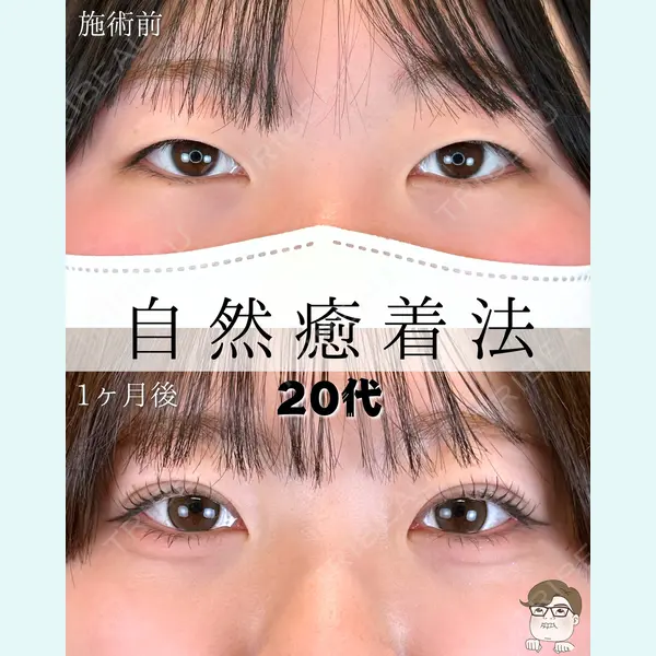 ルラ美容クリニック 札幌本院 佐藤 雄紀医師の症例