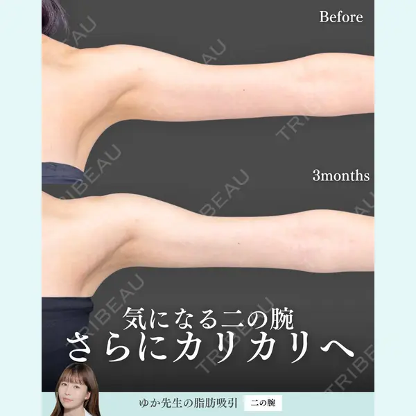 東京シンデレラ美容外科 新宿院 宮﨑友伽医師の症例