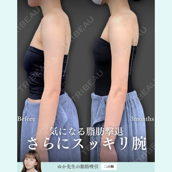 東京シンデレラ美容外科 新宿院 宮﨑友伽医師の症例