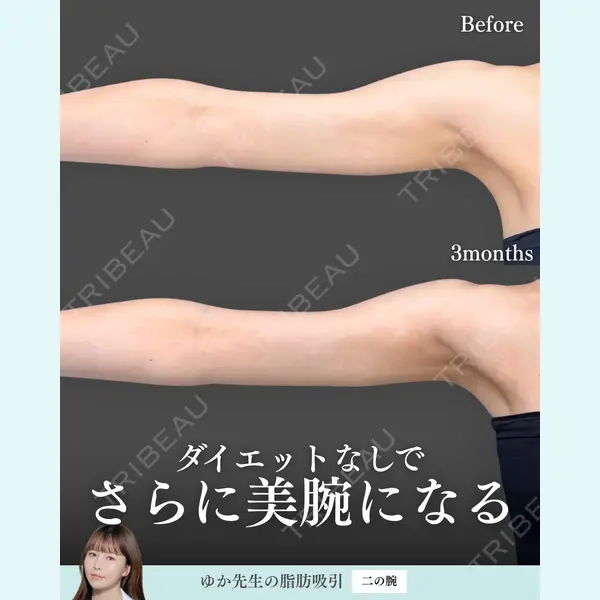 東京シンデレラ美容外科 新宿院 宮﨑友伽医師の症例