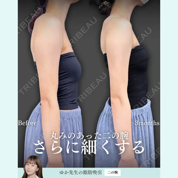 東京シンデレラ美容外科 新宿院 宮﨑友伽医師の症例