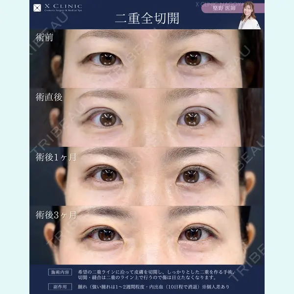 X CLINIC 名古屋院 堅野希実医師の症例