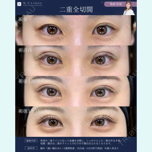 X CLINIC 名古屋院 堅野希実医師の症例