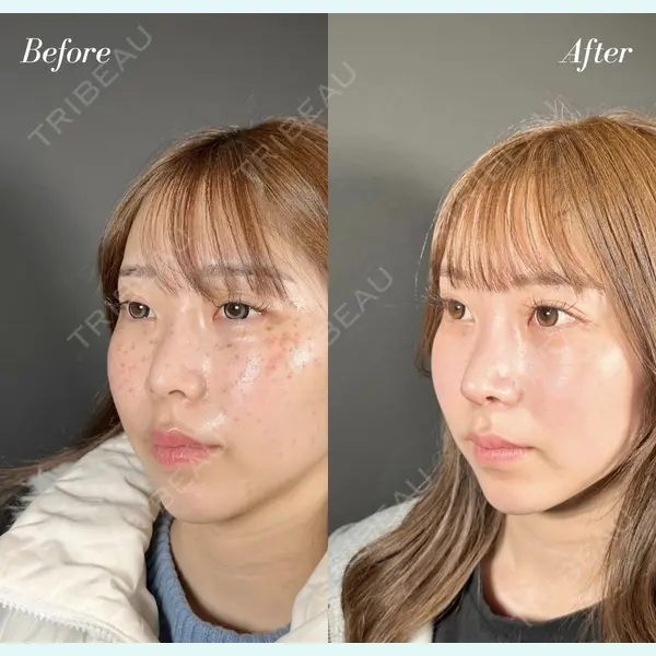 R Beauty CLINIC 名古屋院 木村 尚大医師の症例